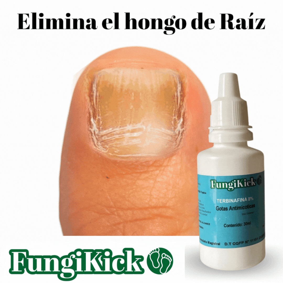FUNGIKICK - GOTA ANTIFÚNGICAS