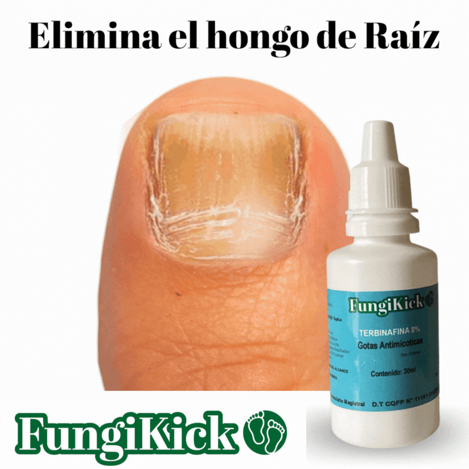 FUNGIKICK - GOTA PARA HONGOS UÑAS