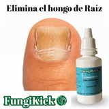 FUNGIKICK - GOTA PARA HONGOS UÑAS