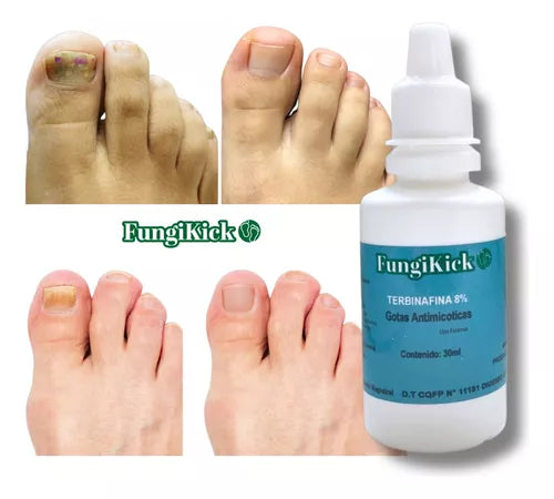 FUNGIKICK - GOTA PARA HONGOS UÑAS